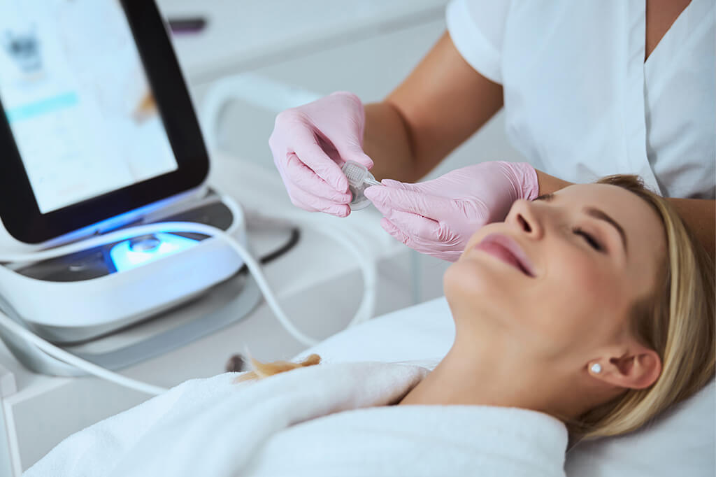 microneedling